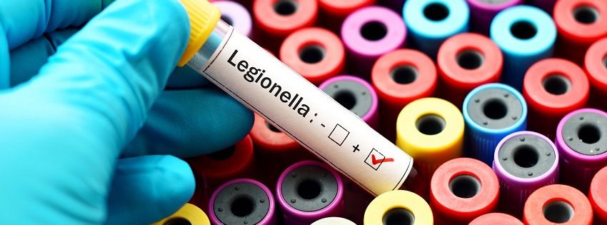 Blood sample positive with legionella